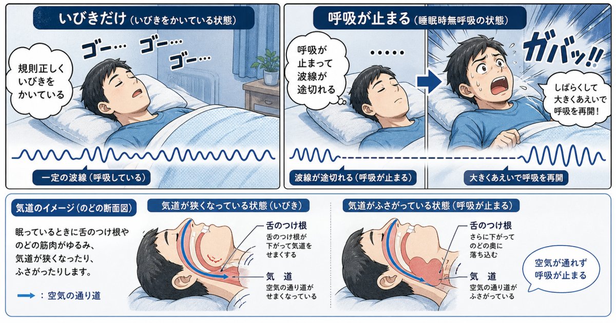 単なるいびきと睡眠時無呼吸症候群（SAS）の決定的な違い